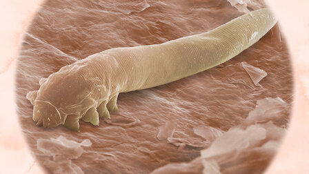 Watch Your Skin. Episode 7 of Season 3.